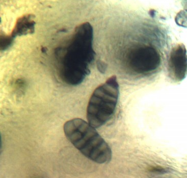 Fungo lichenicolo su Xanthoparmelia tinctina?